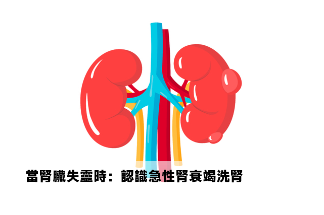 當腎臟失靈時：認識急性腎衰竭洗腎